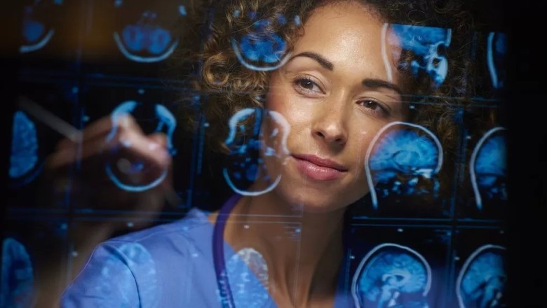 New Alzheimer's drug slows disease by a third