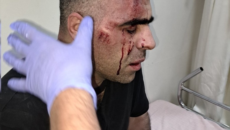 Gazeteci Sinan Aygül'e Saldırı Anı Güvenlik Kamerasına Yansıdı