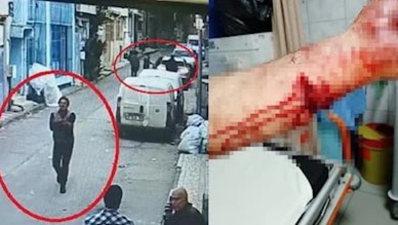 Bursa'da Pitbull Köpeği Saldırısına İlişkin İlginç Savunma