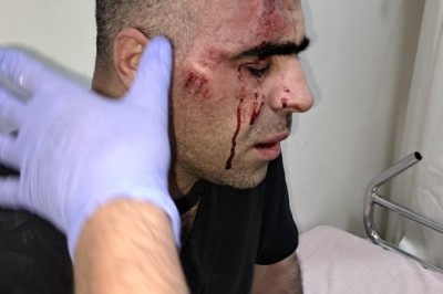 Gazeteci Sinan Aygül'e Saldırı Anı Güvenlik Kamerasına Yansıdı